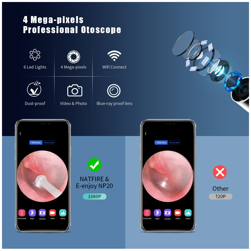 Wireless Smart Visual Ear Cleaner with Camera Ear Endoscope 1080P, Compatible with iPhone, iPad, Android Smart Phones & Tablets
